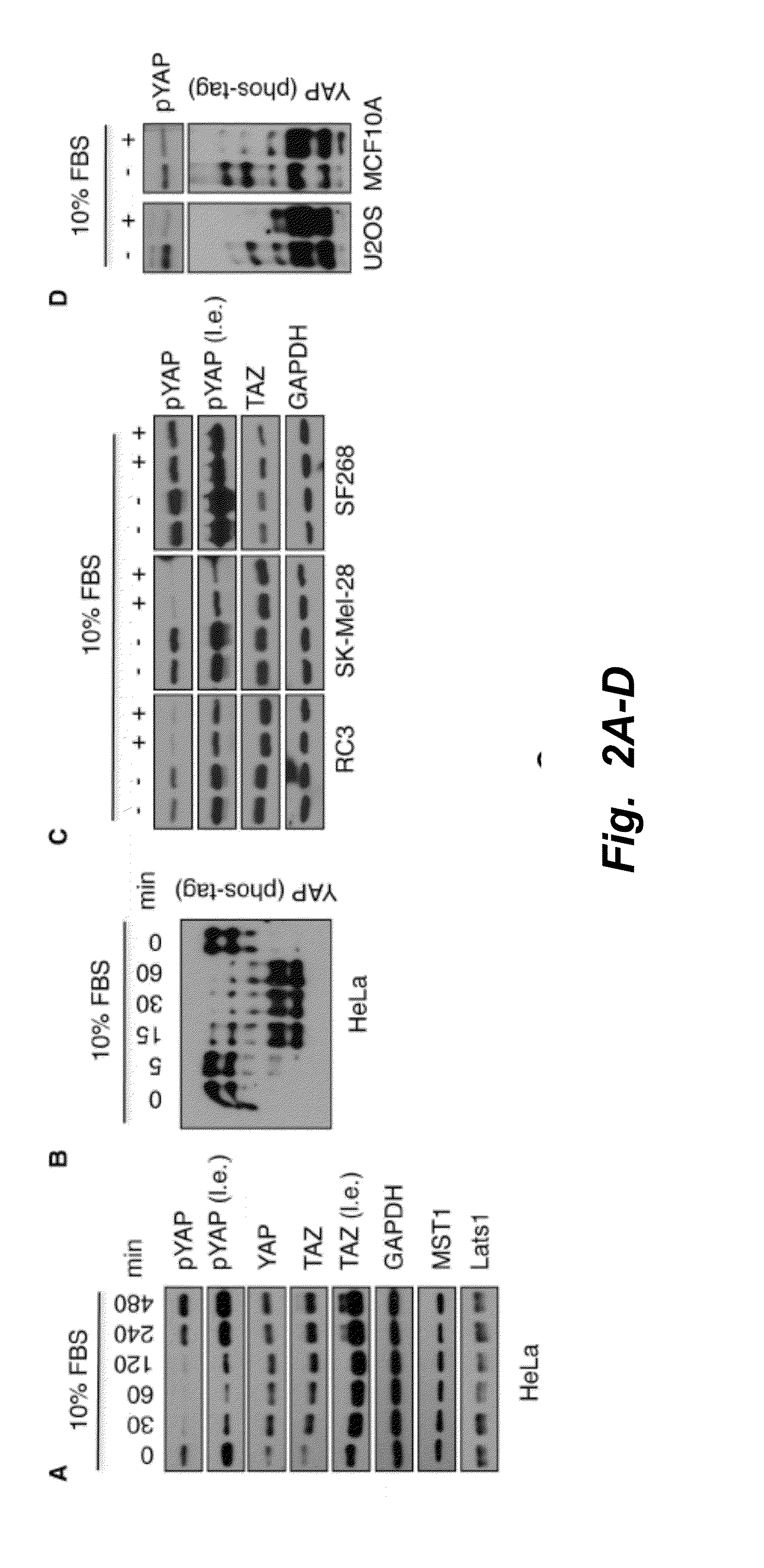 Inhibitors of hippo-yap signaling pathway