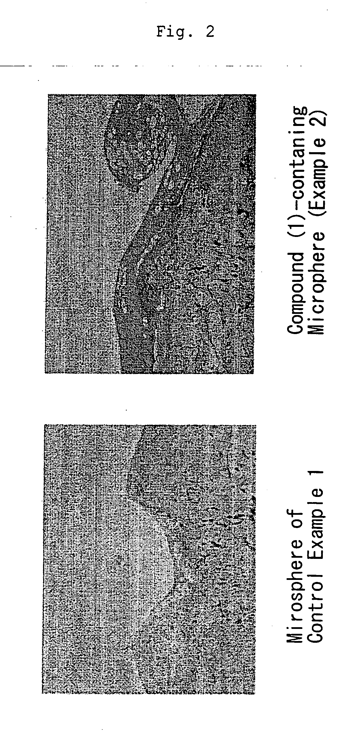 Composition for regenerative treatment of cartilage disease