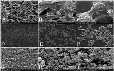 A caries-resistant Lactobacillus plantarum and its application