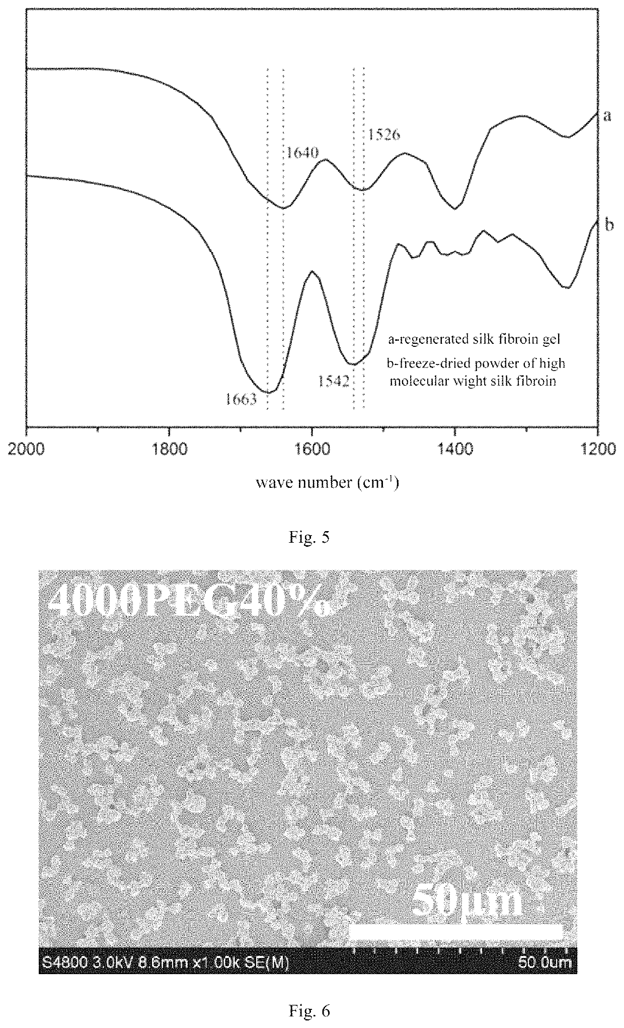 Freeze-dried powder of high molecular weight silk fibroin, preparation method therefor and use thereof