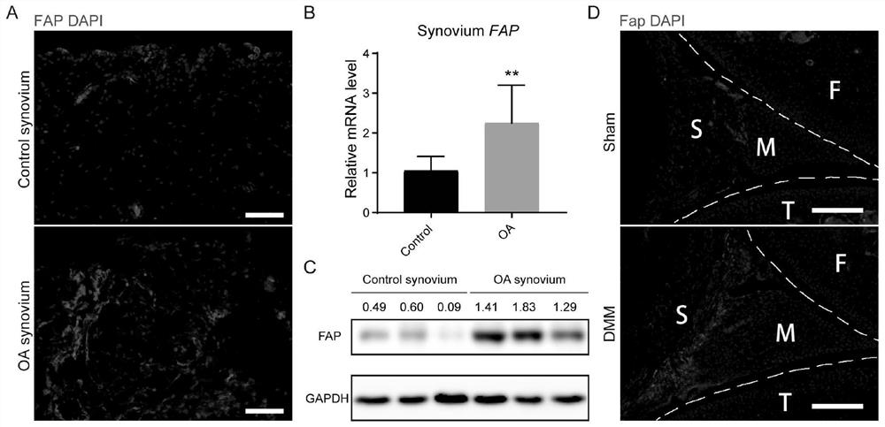 Application of fibroblast activation protein (Fap) as drug target in treatment of osteoarthritis (OA)