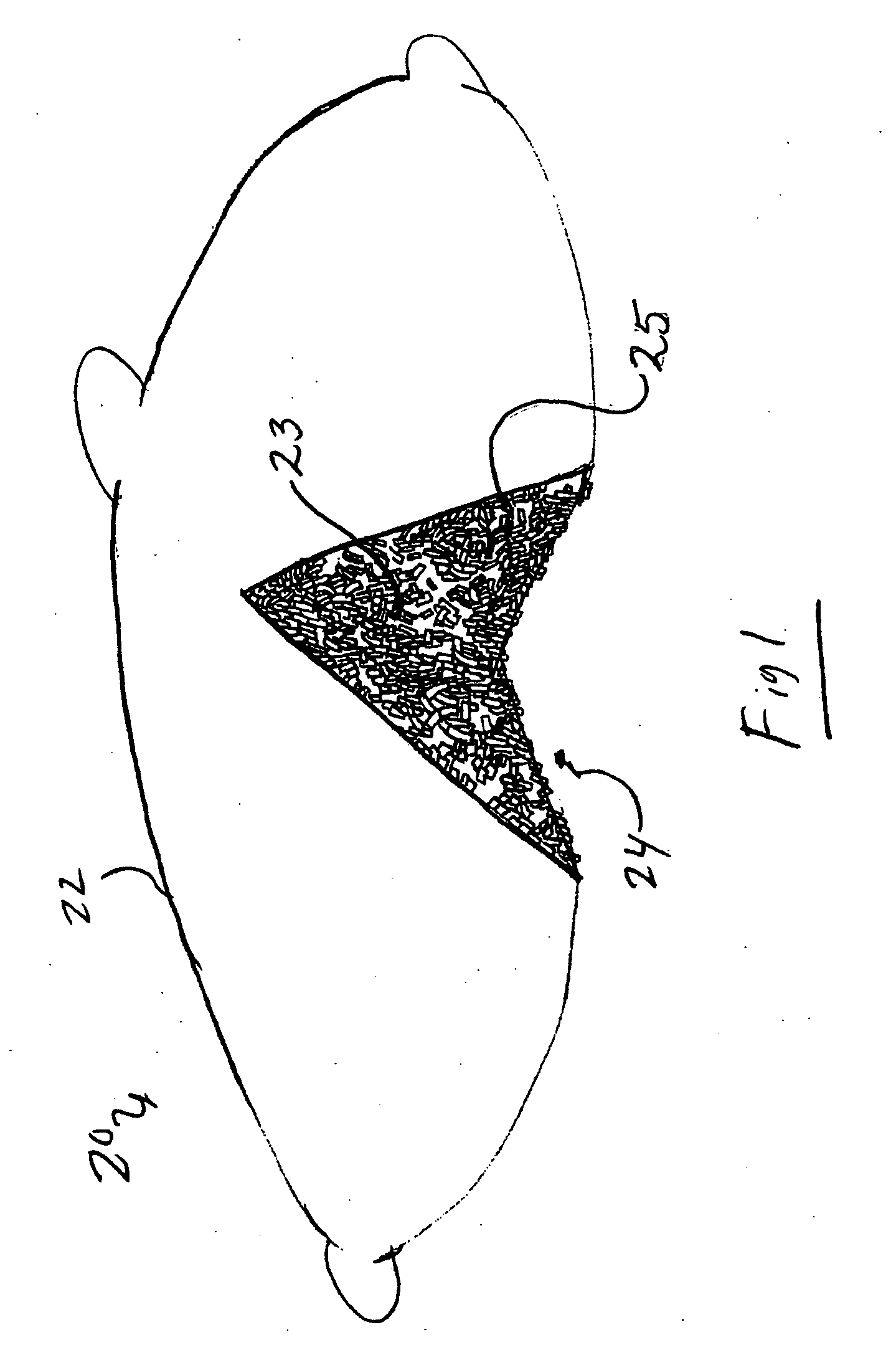 Reticulated open cell filling material