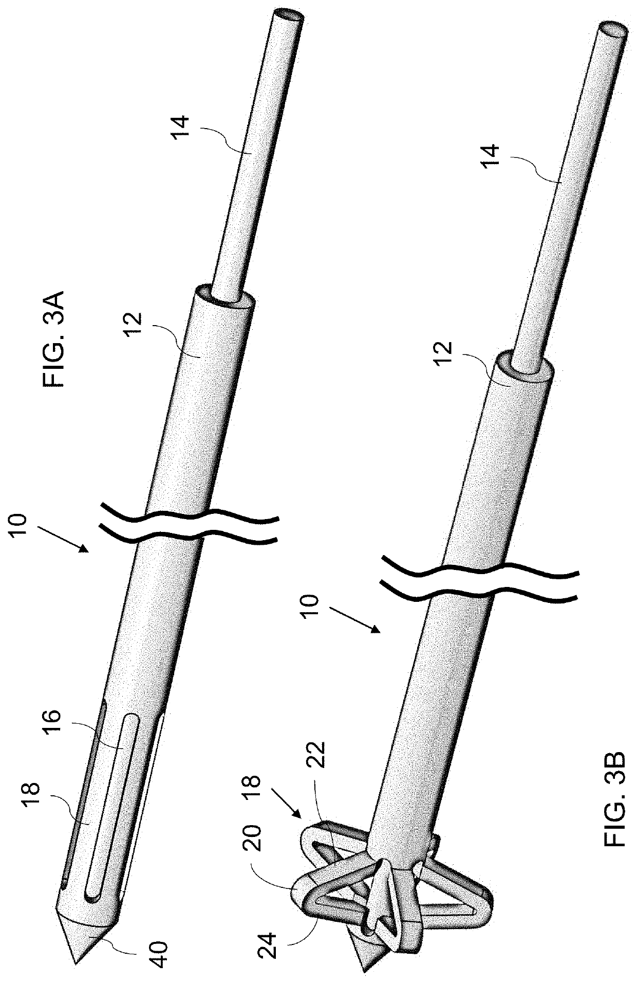 Stiff guide wire with anchoring configuration