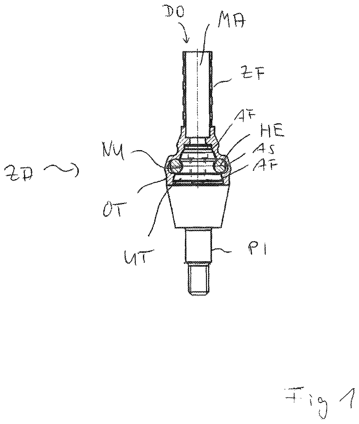 Dental prosthesis arrangement