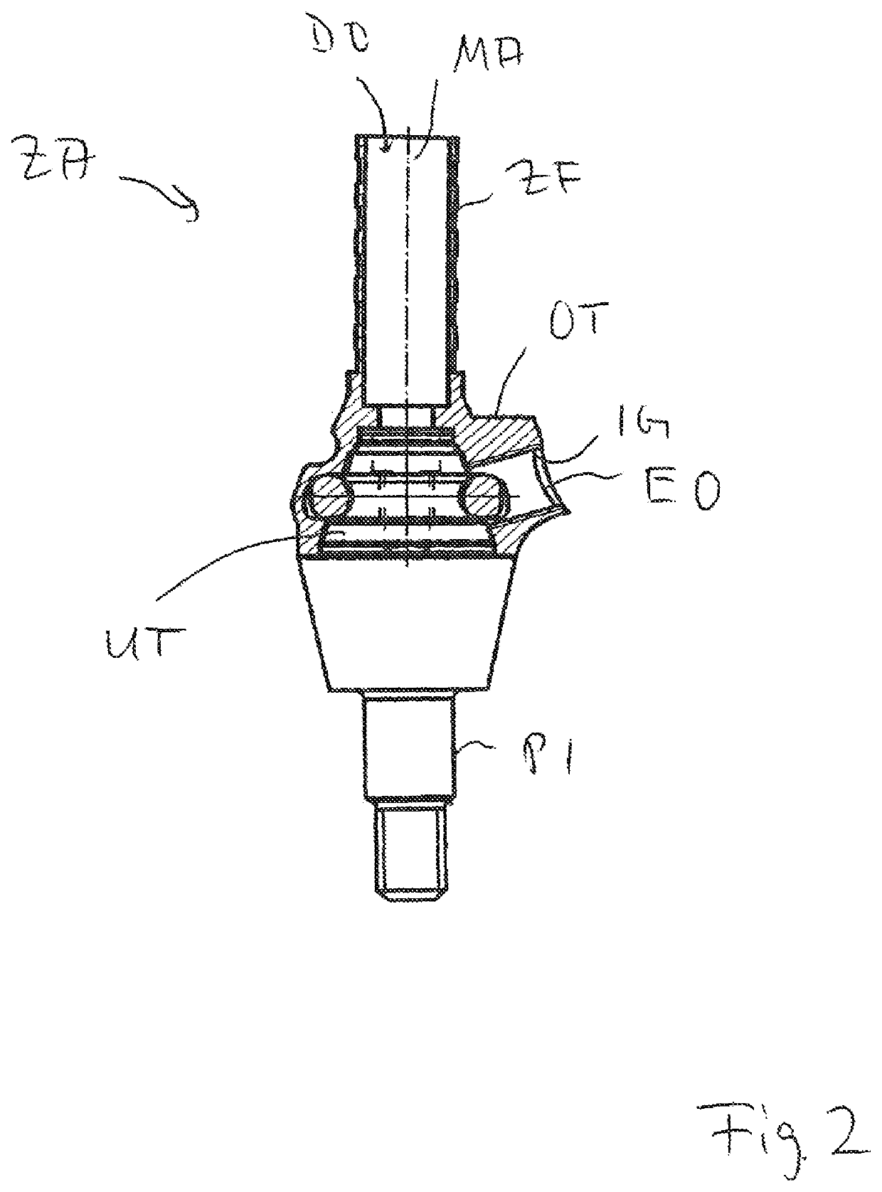 Dental prosthesis arrangement