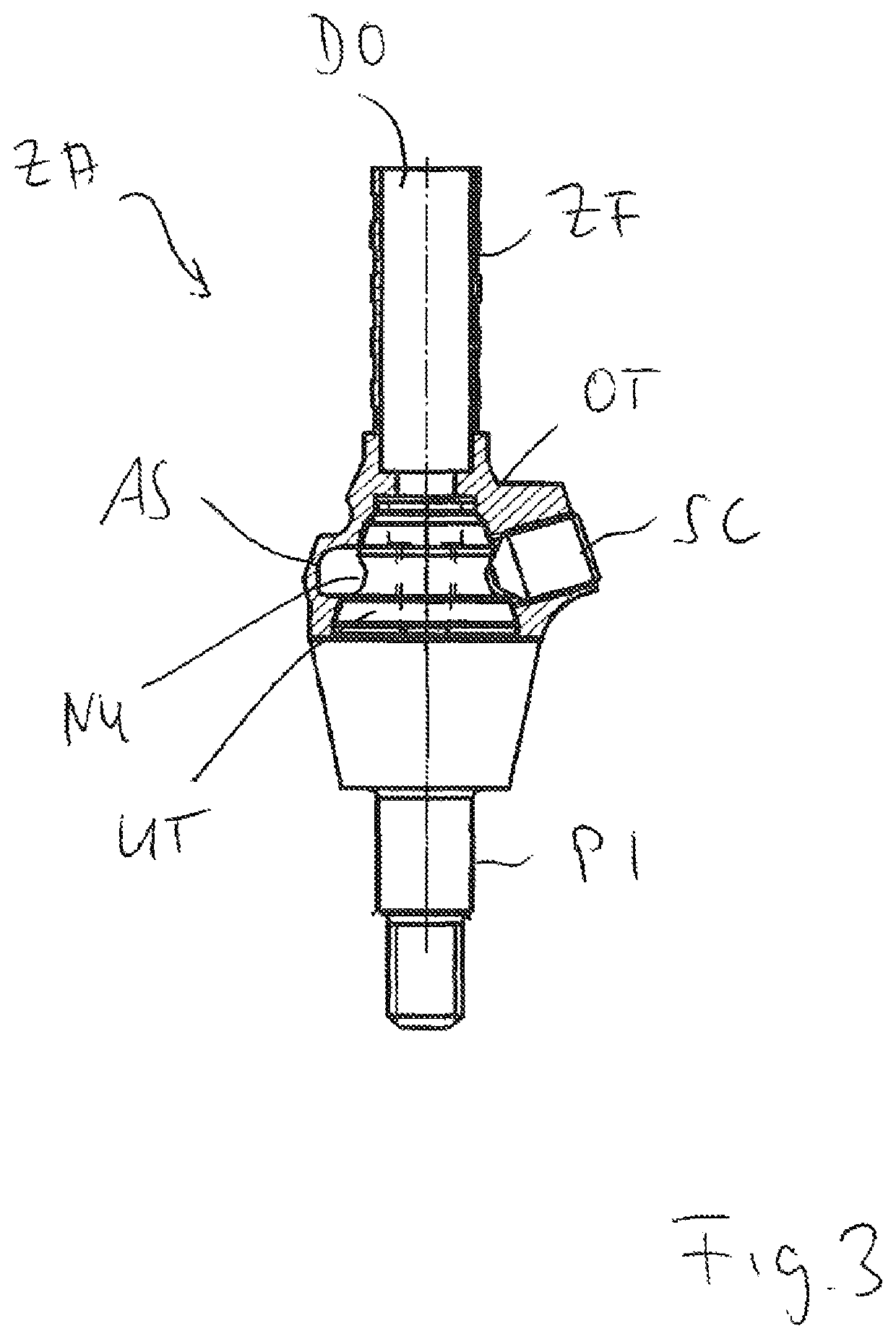 Dental prosthesis arrangement