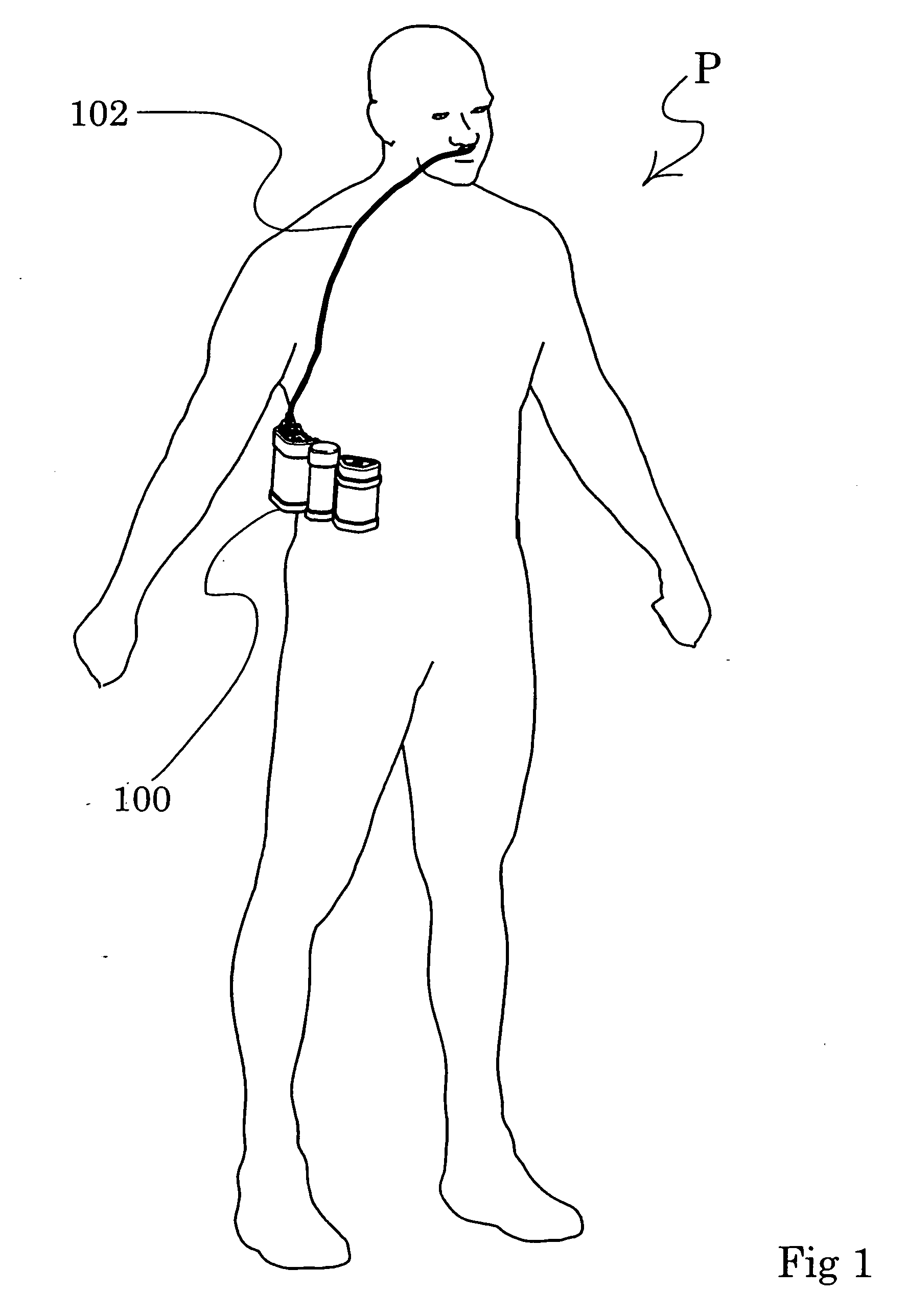 Ambulatory oxygen concentrator containing a power pack