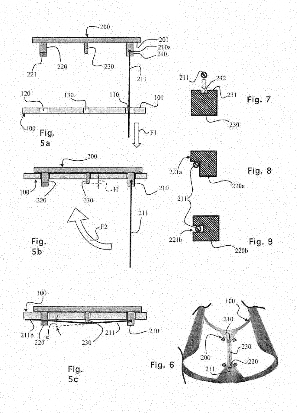 Decorative object, such as an item of jewellery, comprising a body and a decorative element fastened in a reversible manner to the body