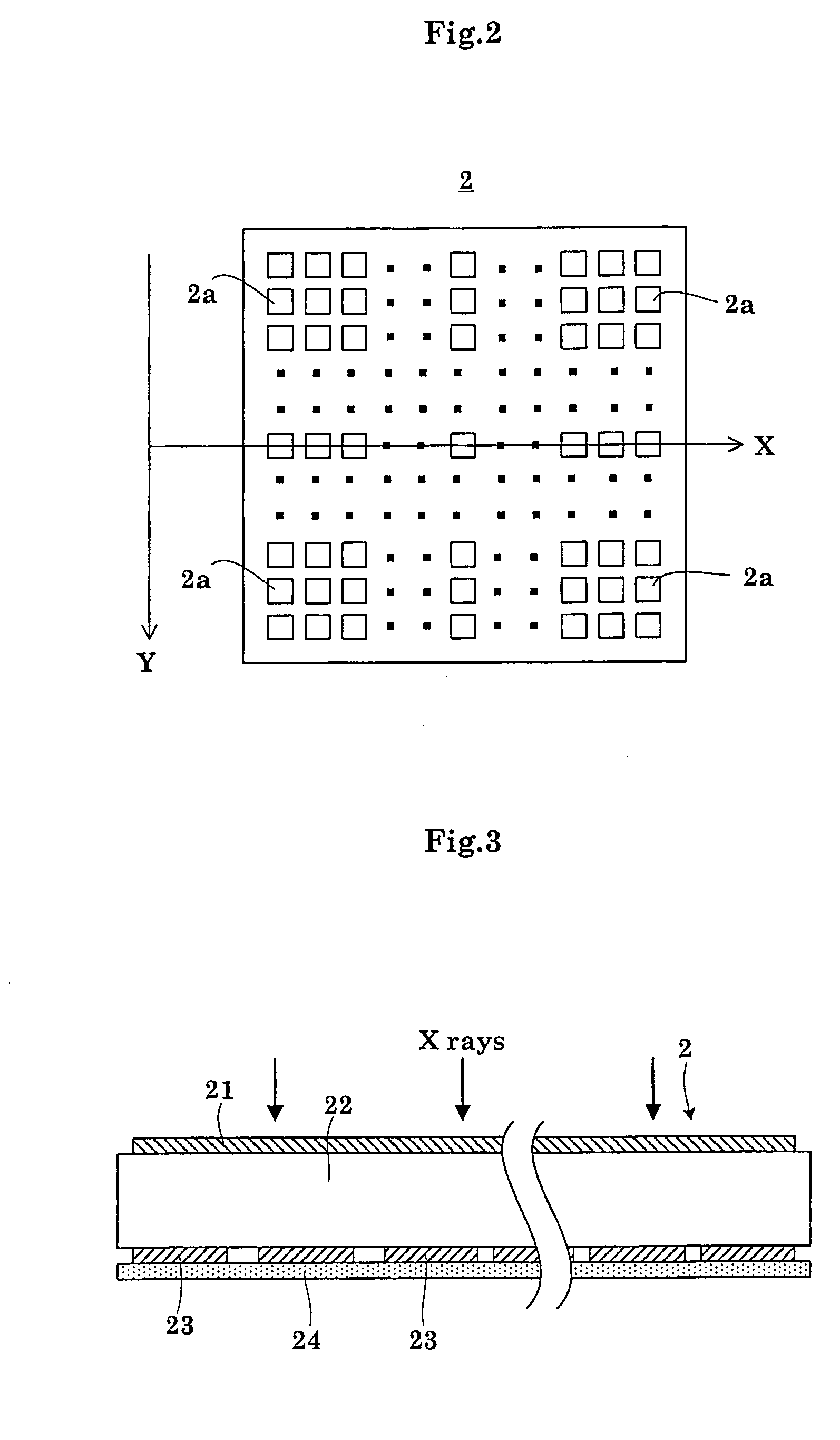 Radiographic apparatus and radiation detection signal processing method