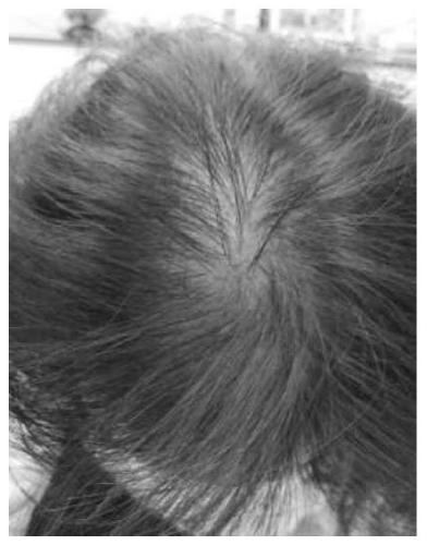 A kind of traditional Chinese medicine anti-hair loss composition for women