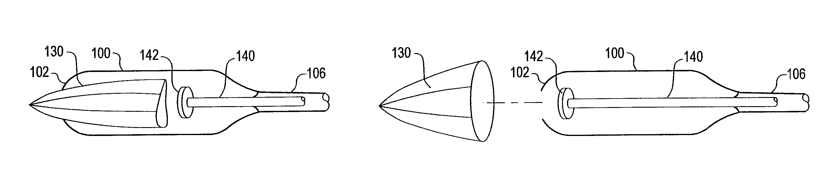 Apparatus and method for deployment of a bronchial obstruction device