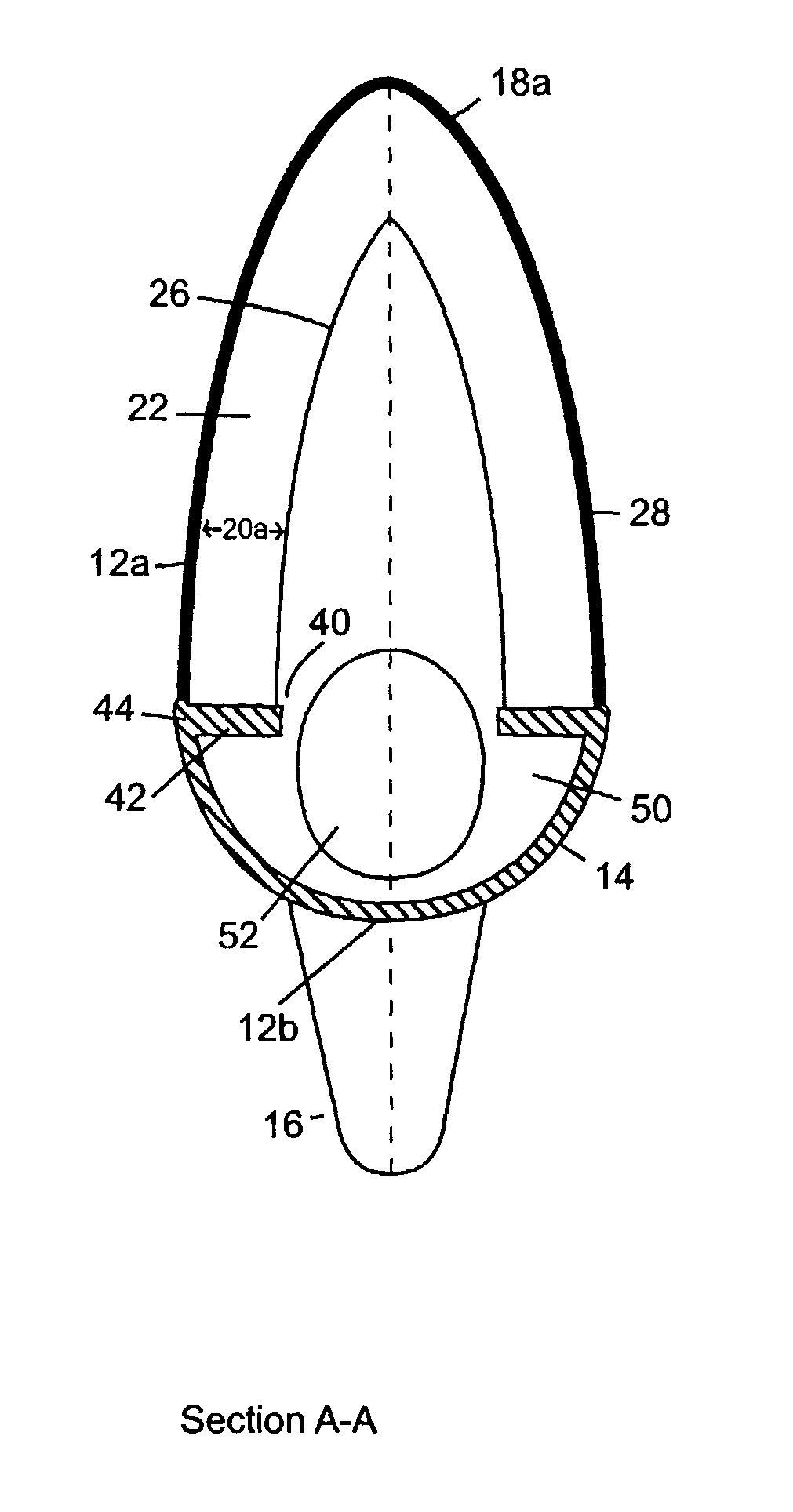 Apparatus for extra-labial urine voiding