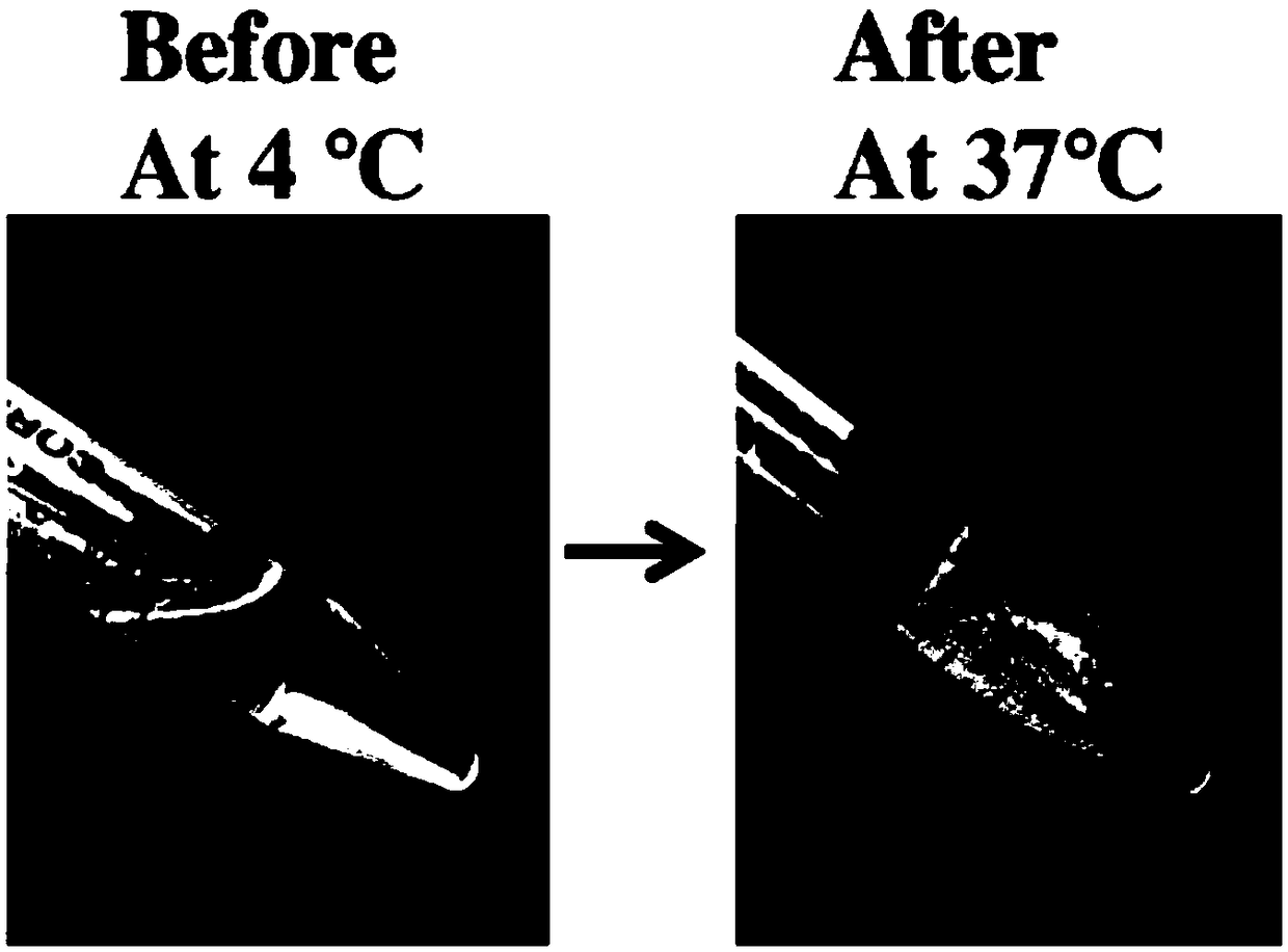 Preparation method of temperature-sensitive chitosan hydrogel cell factor composite stent