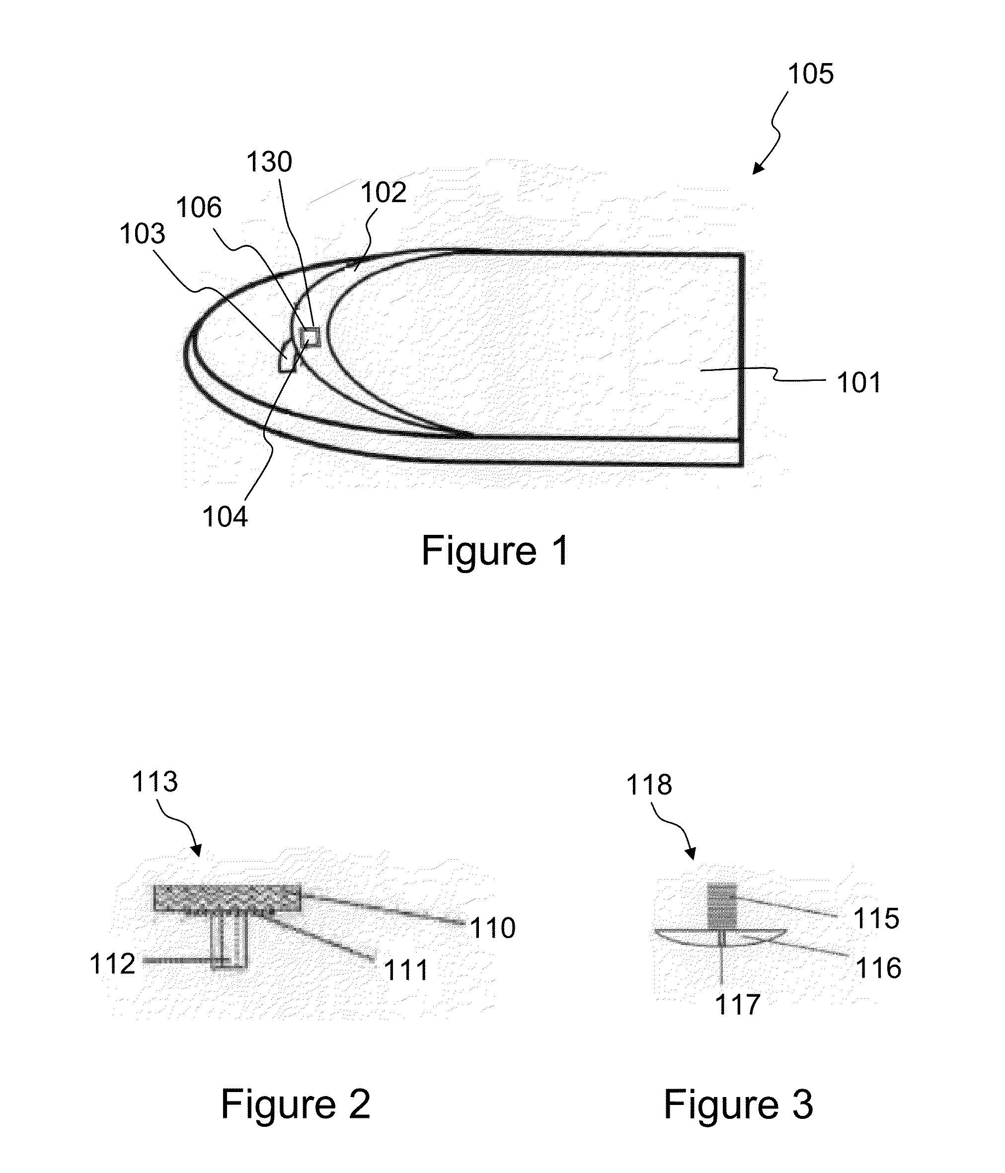 Systems and methods for customizable, embellishments