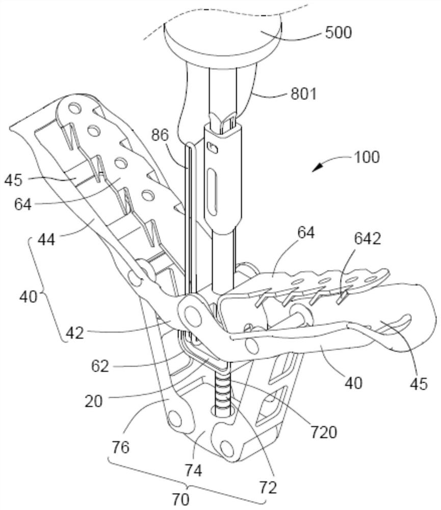 Valve clamping device with locking mechanism and valve repair system