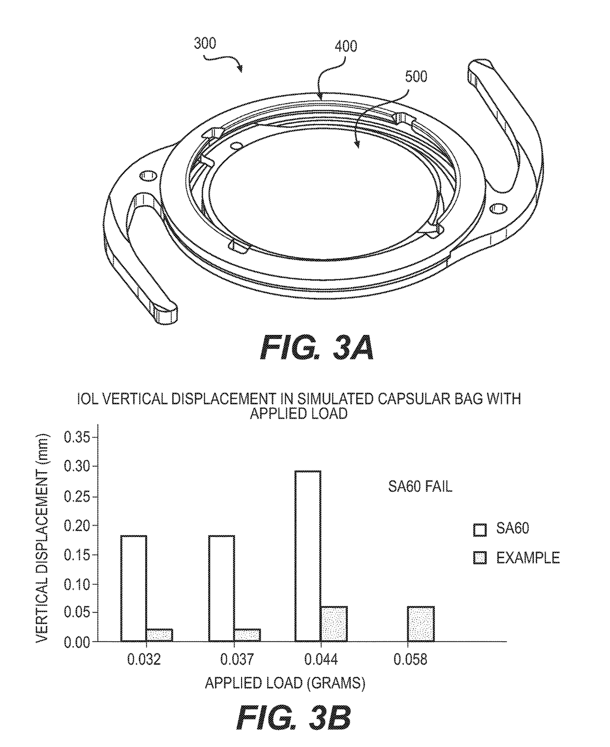 Intraocular lens designs for improved stability