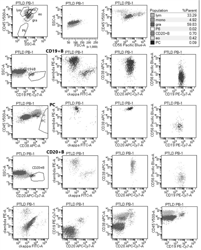 Antibody composition and its application in screening lymphoproliferative diseases after transplantation