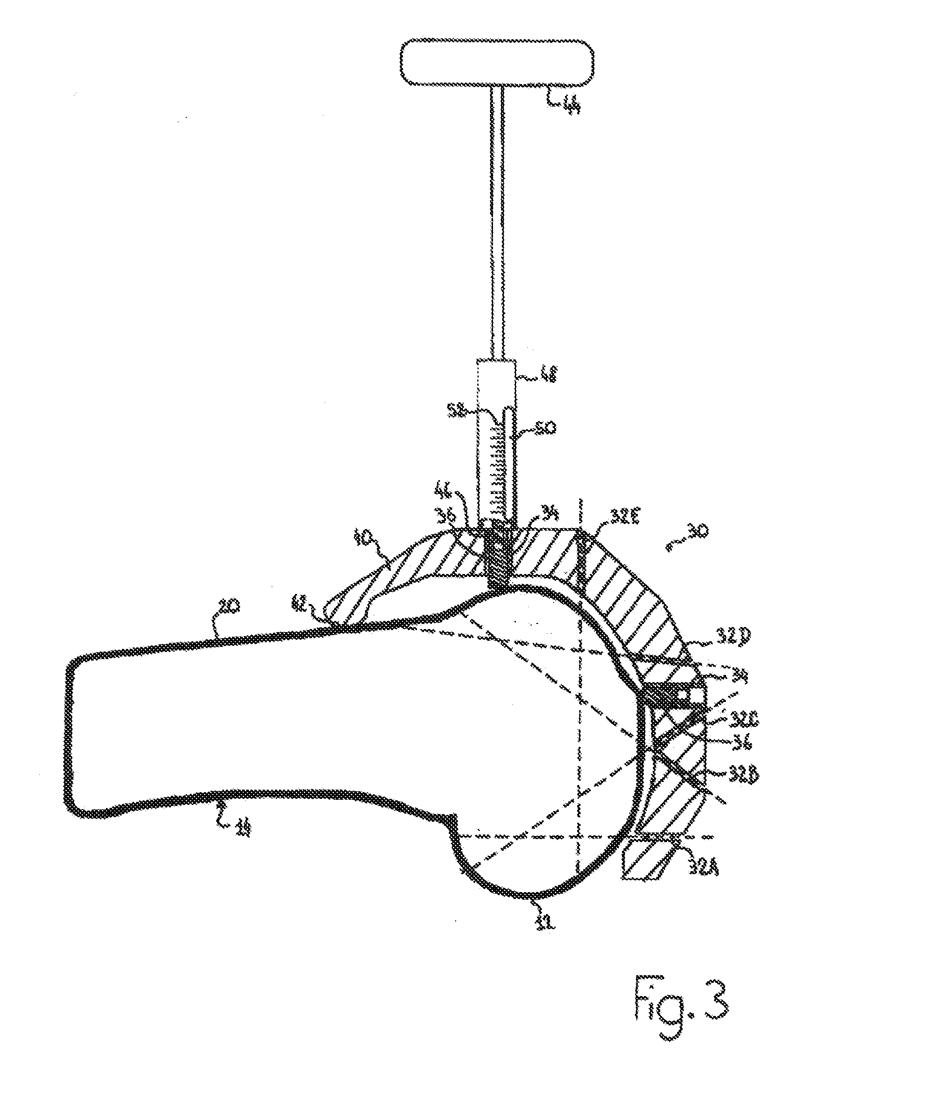 Device for positioning a bone cutting guide