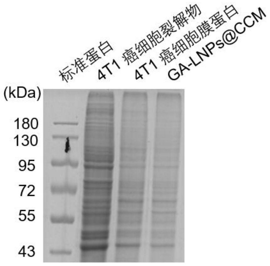 Cancer cell membrane-coated drug-loaded lignin nanoparticles as well as preparation method and application thereof