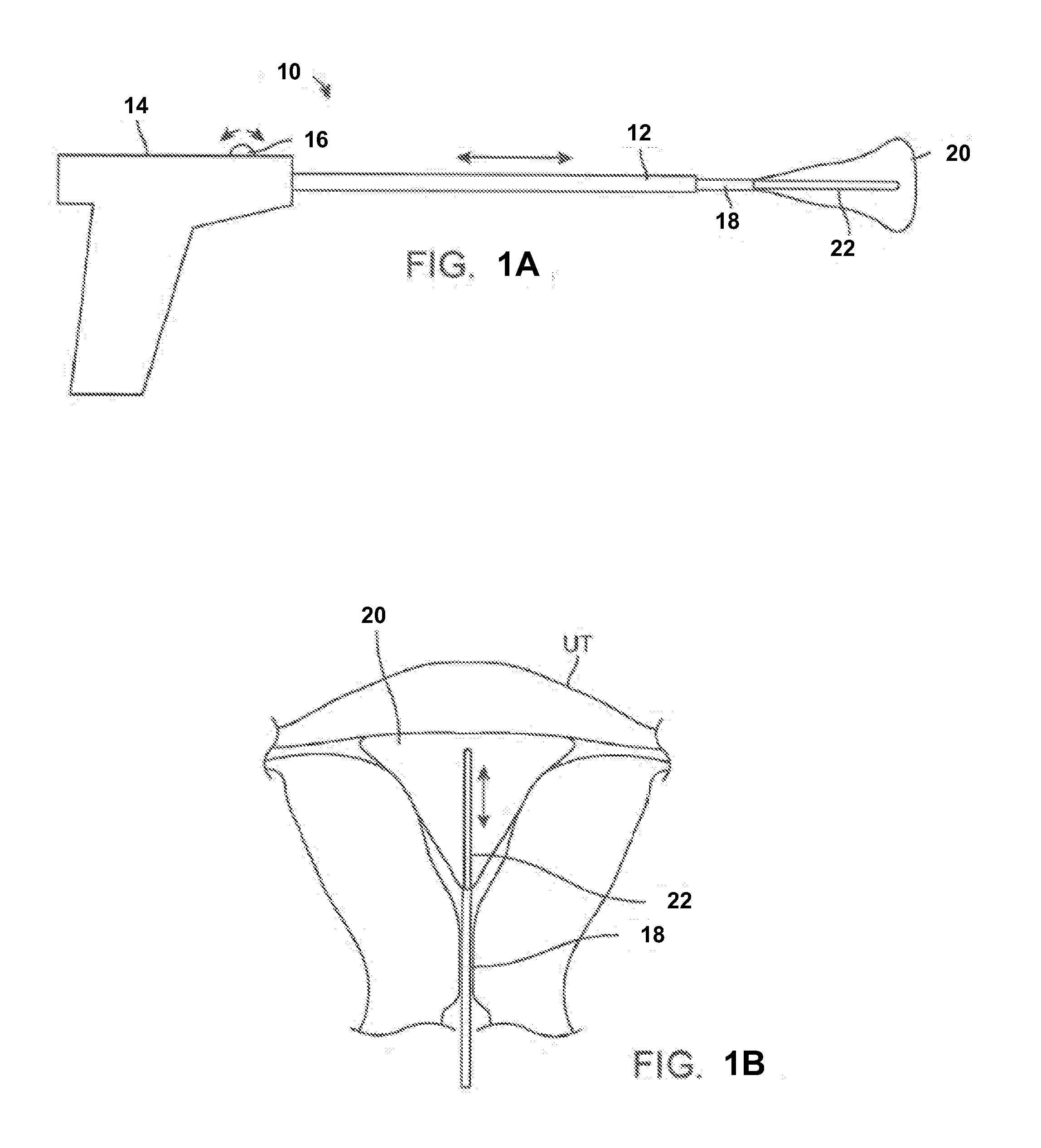 Liner for cyrogenic treatment systems