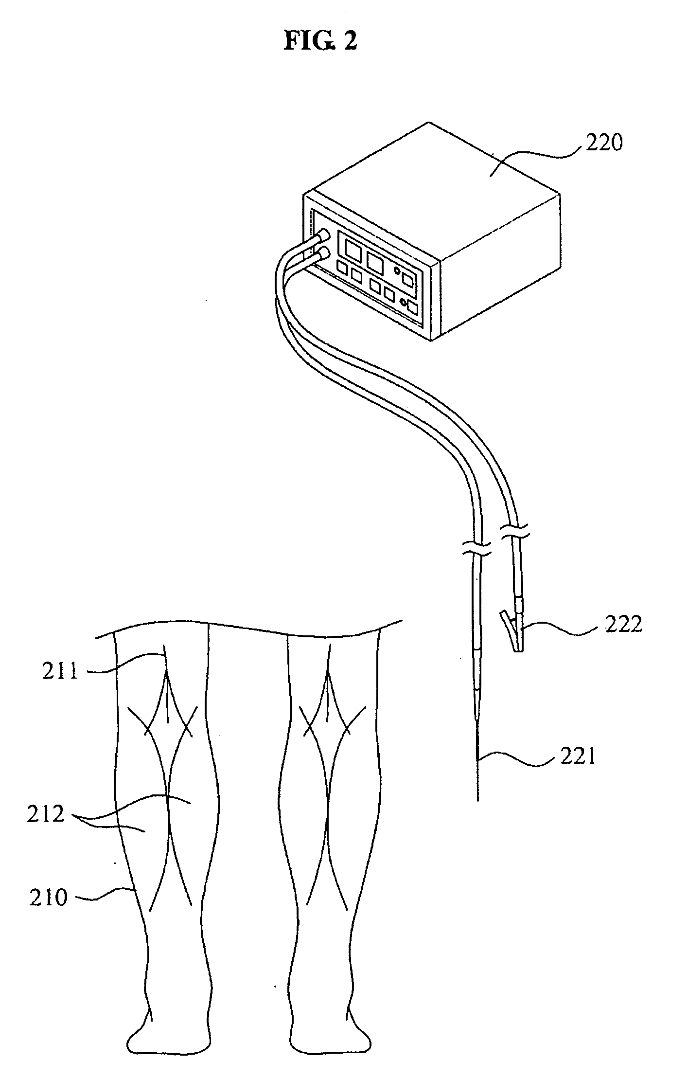 Surgical method for gastrocnemius muscle reduction