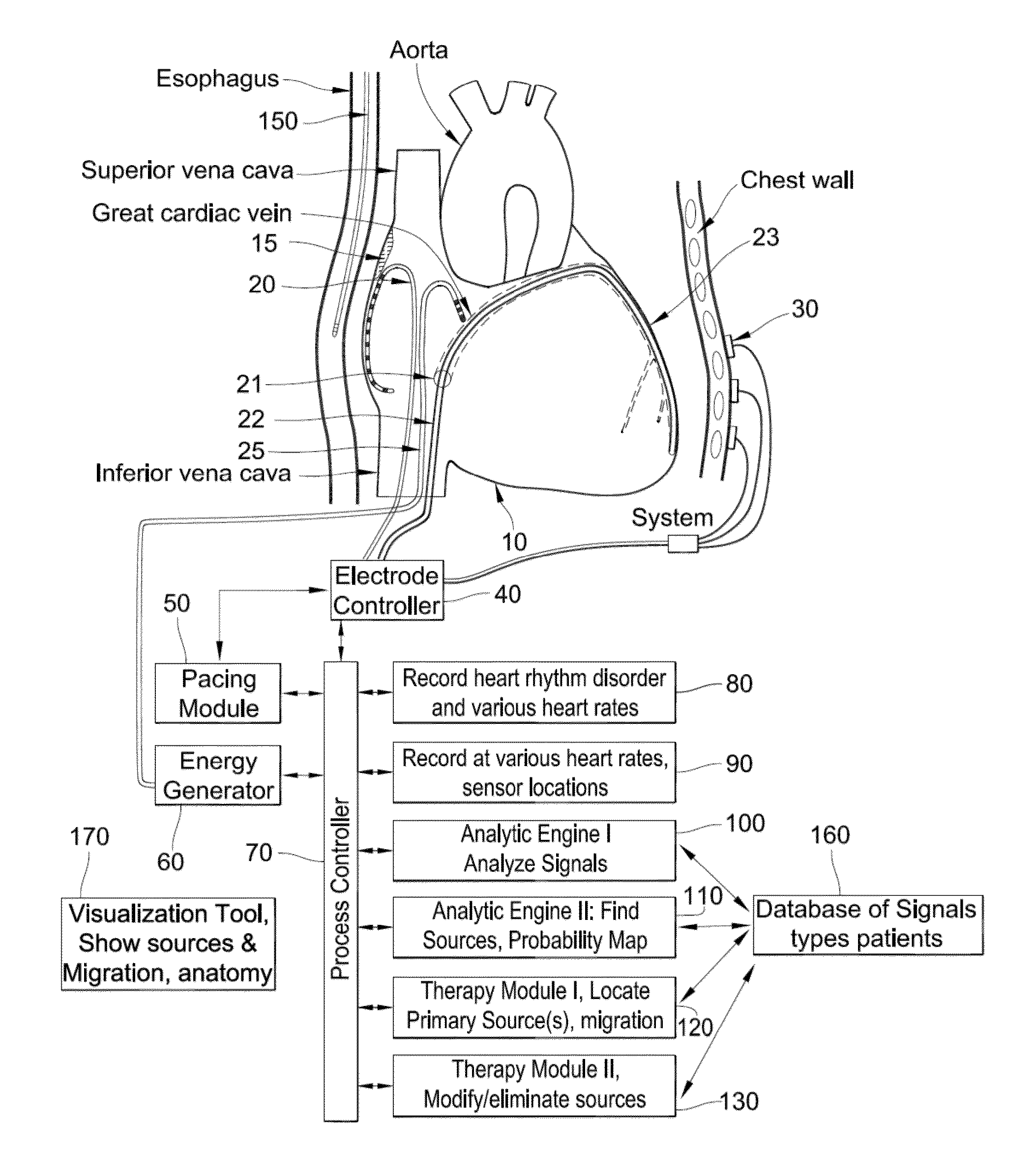 System and method for targeting heart rhythm disorders using shaped ablation