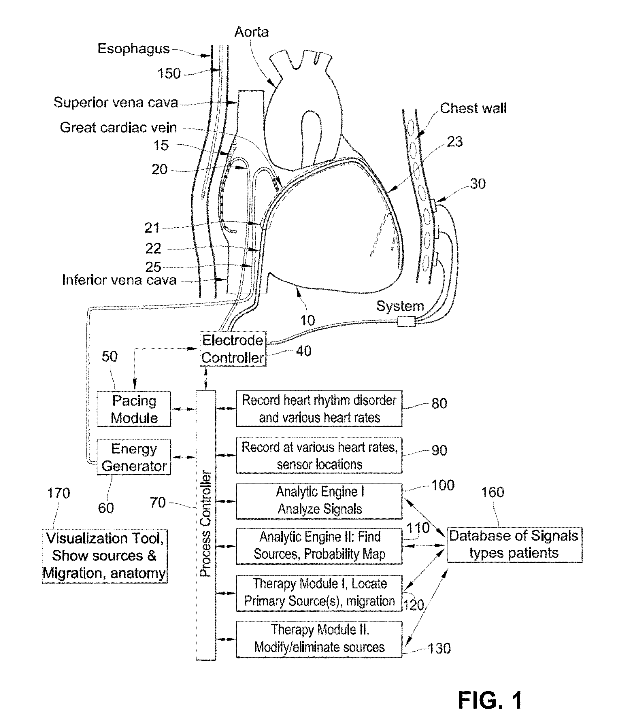 System and method for targeting heart rhythm disorders using shaped ablation