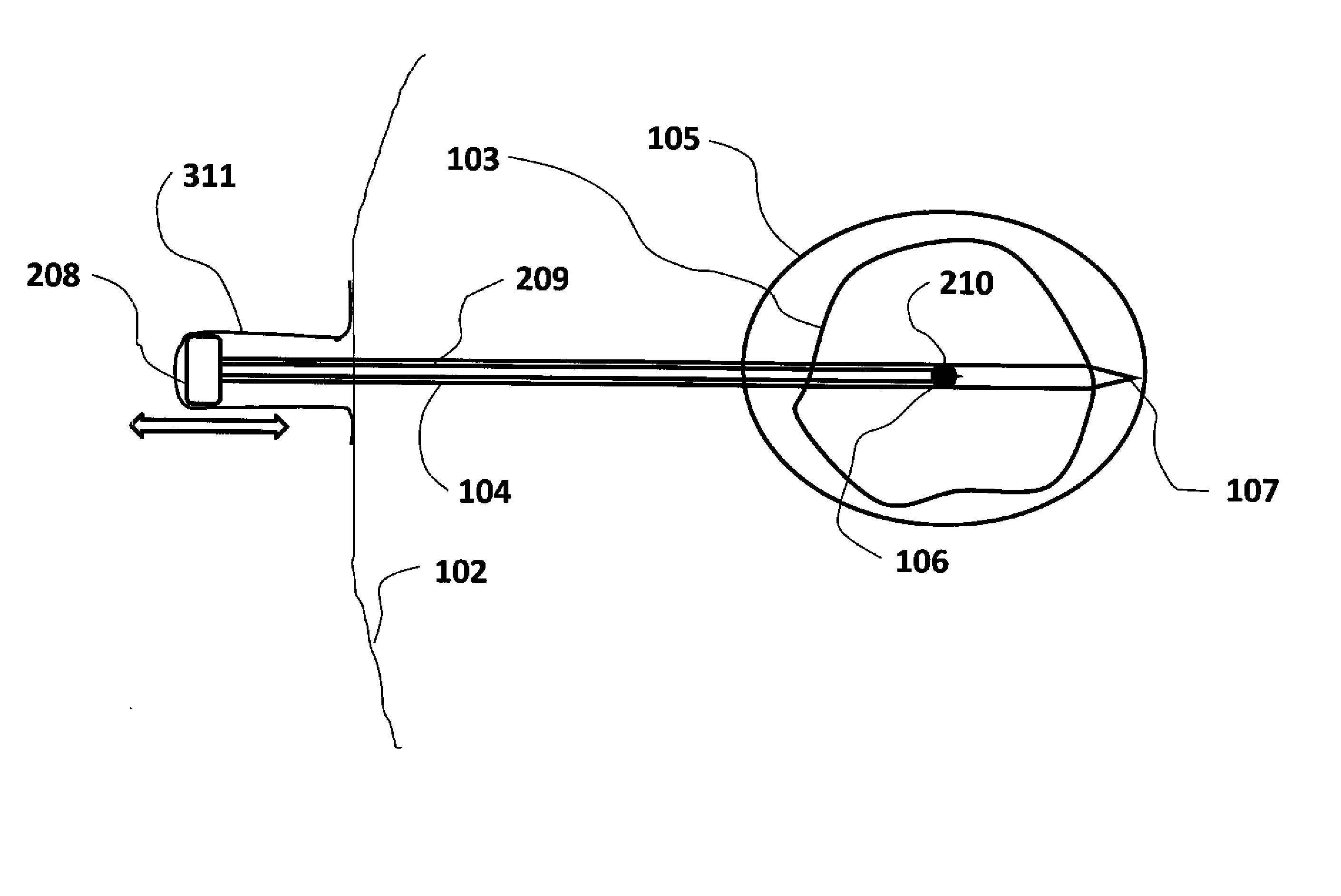Combined cryotherapy and brachytherapy device and method