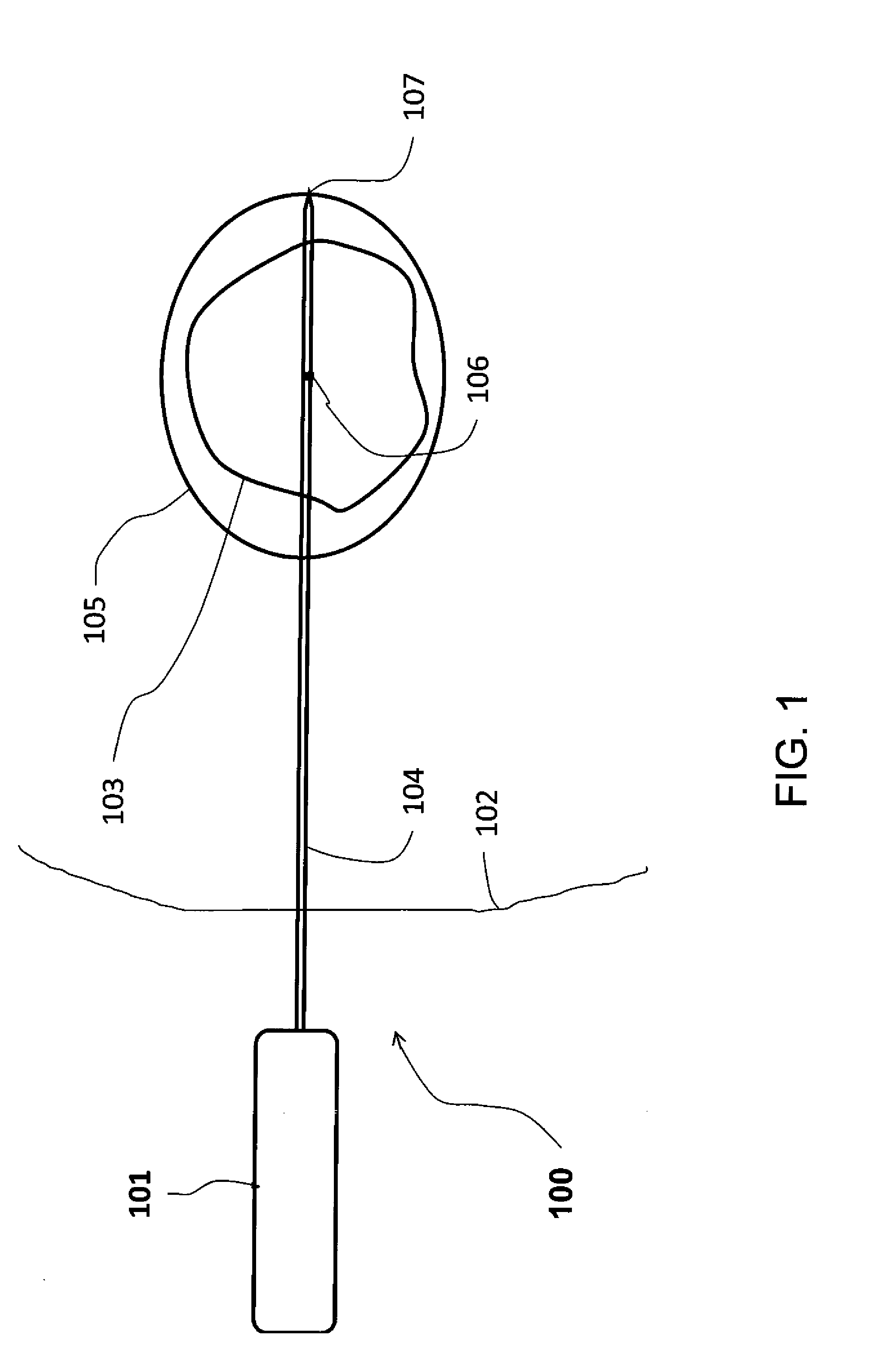 Combined cryotherapy and brachytherapy device and method