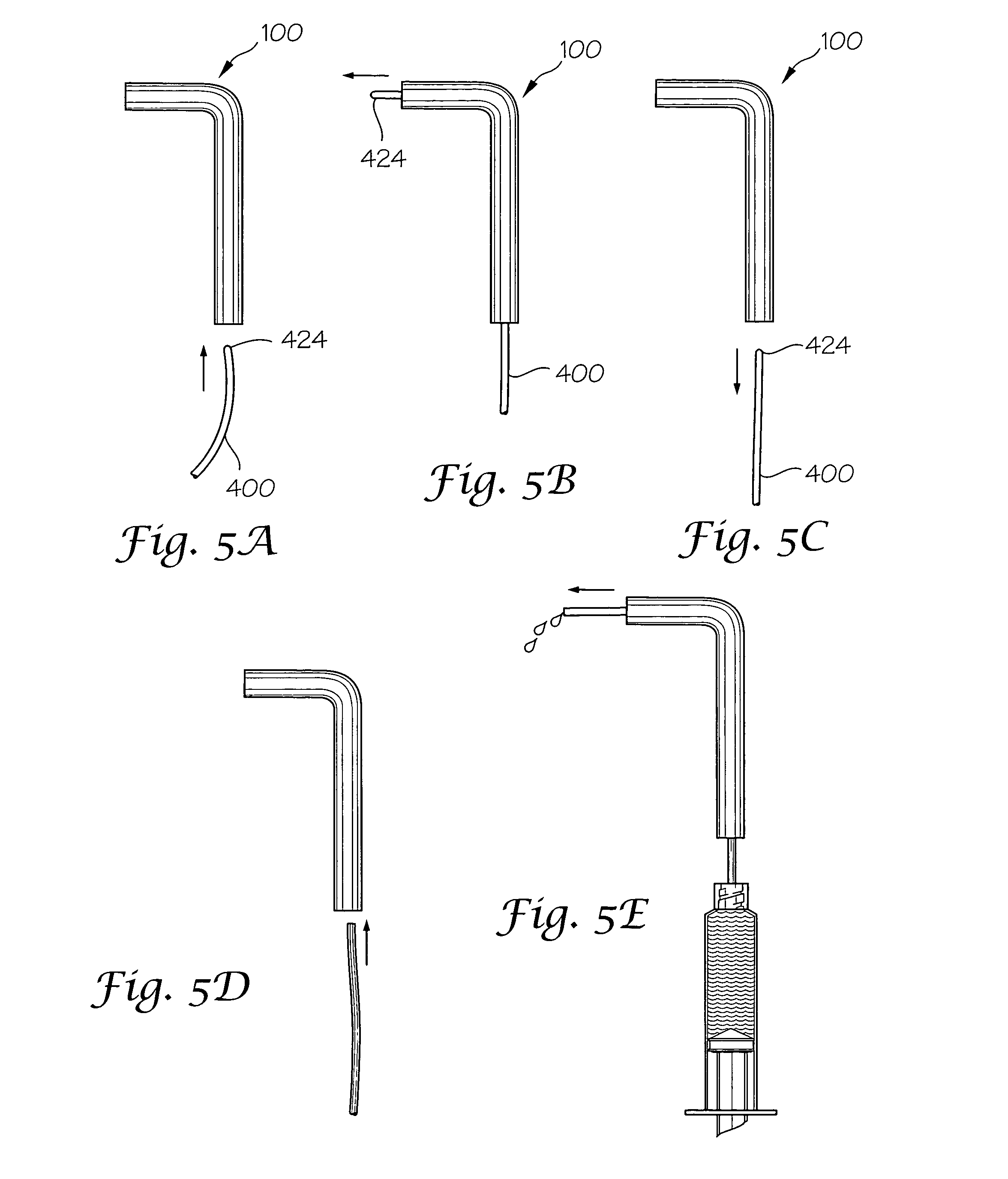 Methods and apparatus for intraoperative administration of analgesia