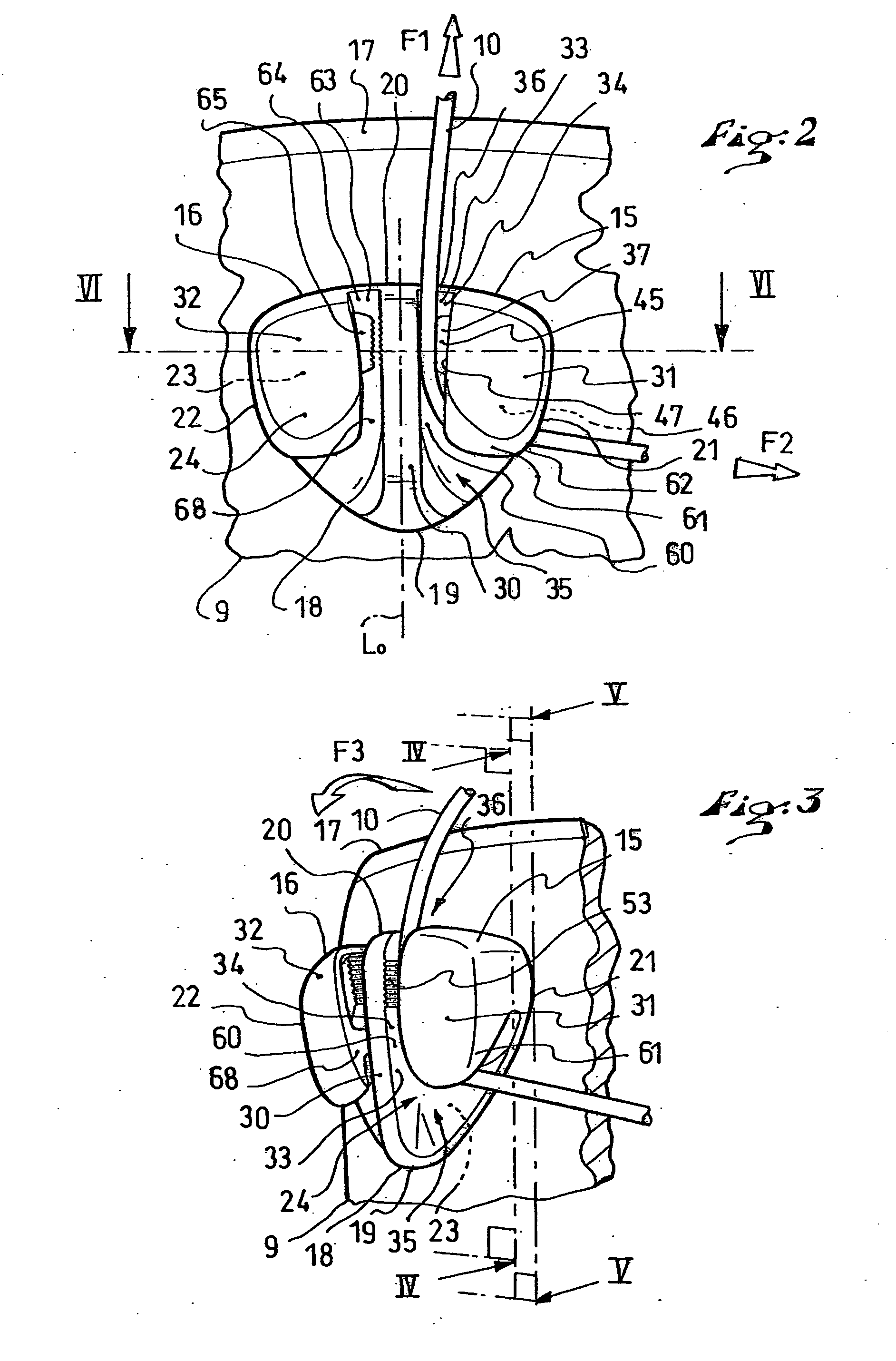 Device for blocking flexible strands