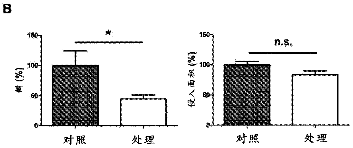 Integrin alpha 9 blockade suppresses lymphatic valve formation and promotes transplant survival