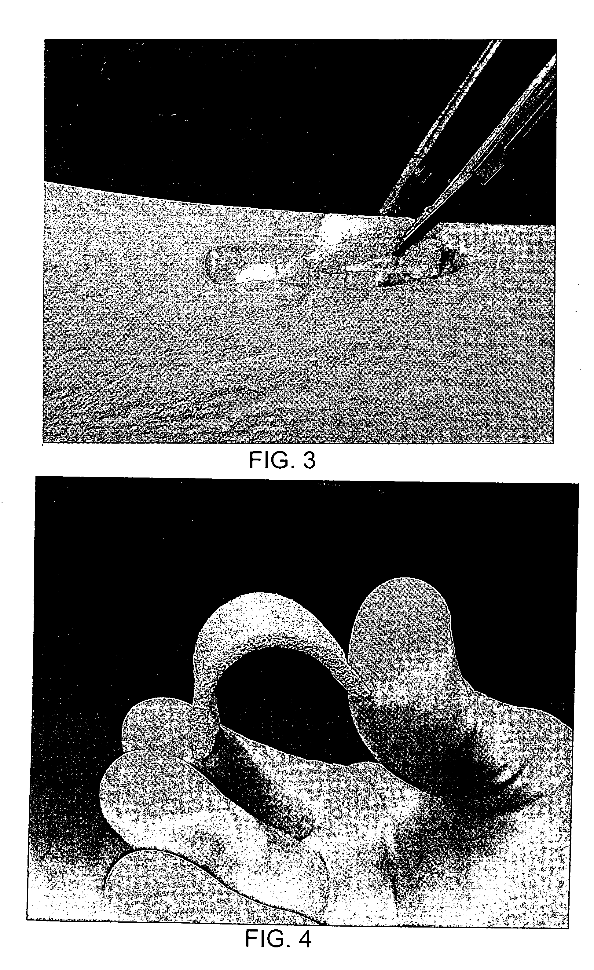 Pliable medical device and method of use