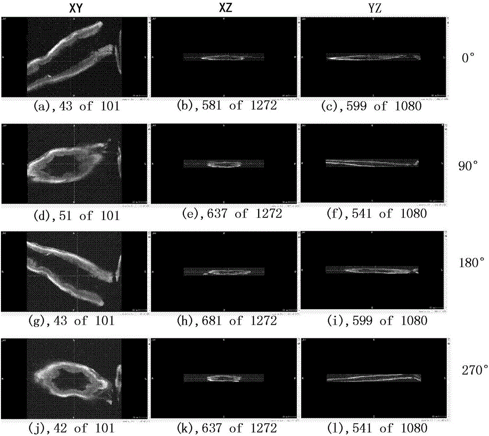 Multi-angle based selective light-sheet illumination microscopy imaging reconstruction method