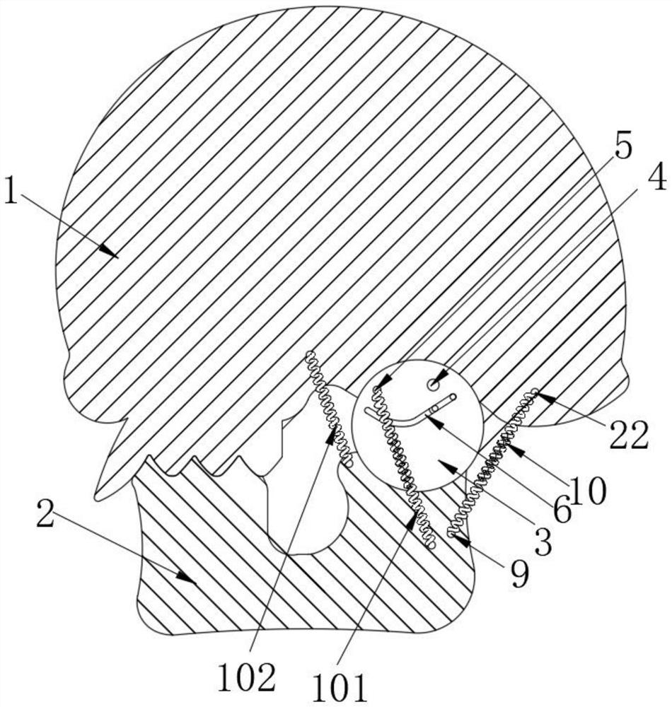 Three-dimensional skull model with temporomandibular joint disc