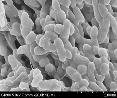 A strain of Providencia rettgeri capable of degrading aniline and denitrification and its application