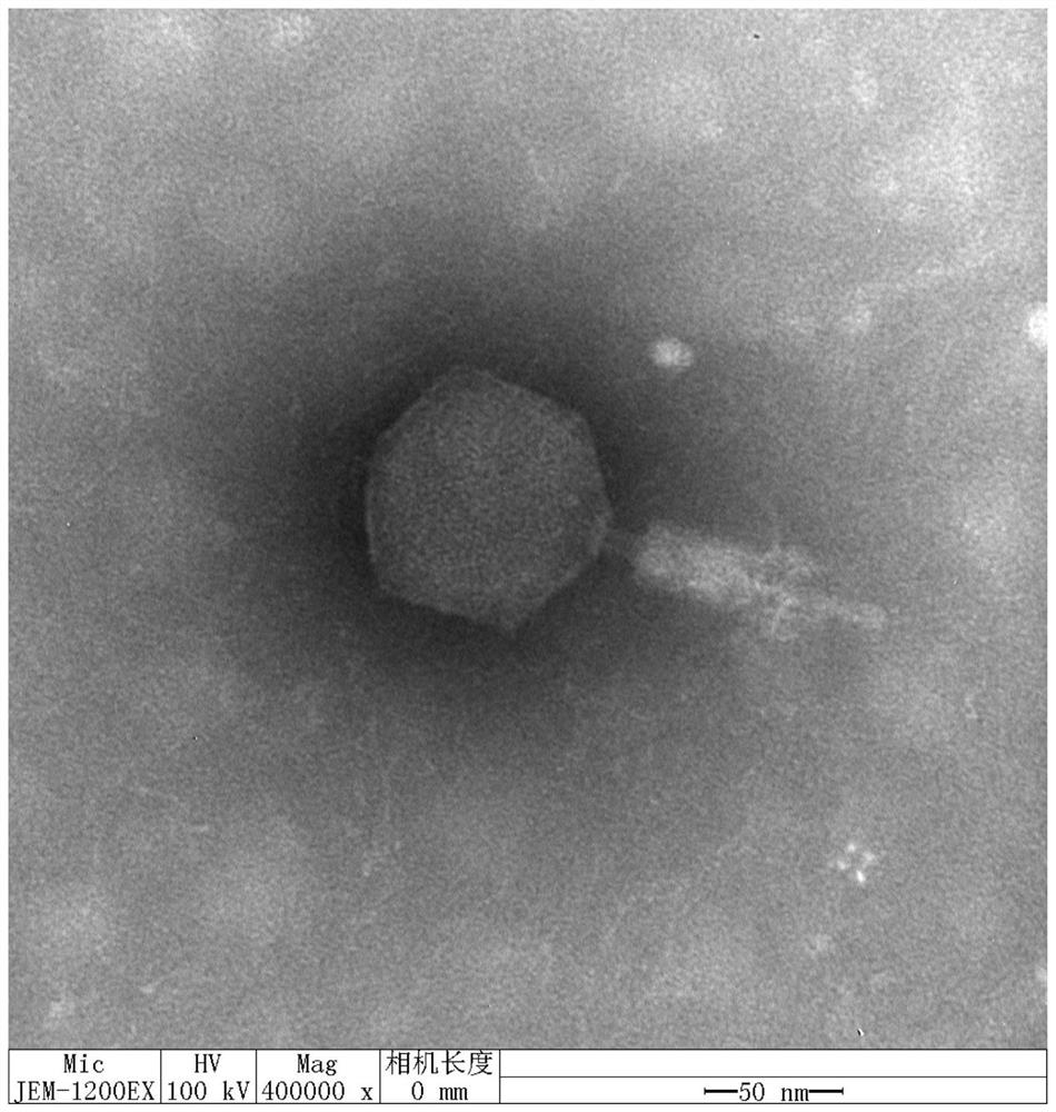 Alkali-resistant vibrio alginolyticus phage and composition, kit and application thereof