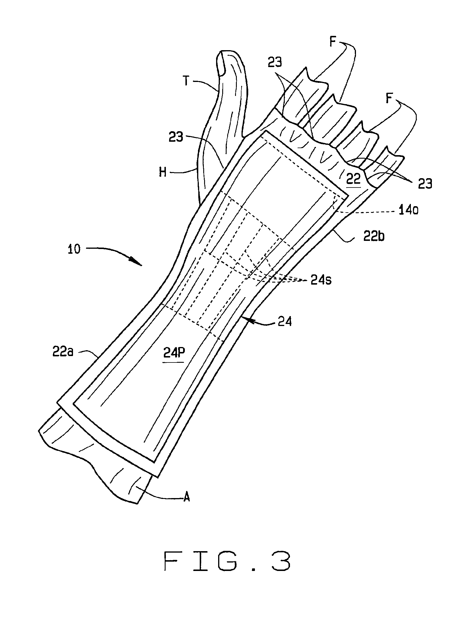 Carpal tunnel splint for wear during non-working periods
