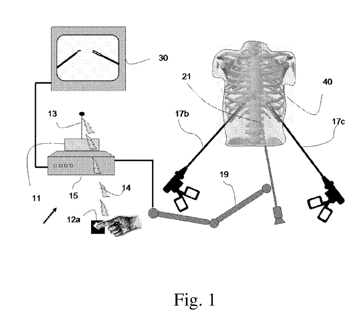 Device and method for assisting laparoscopic surgery - rule based approach