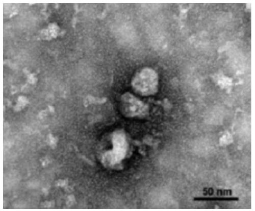 Obtaining method and application of exosomes derived from human urine cells