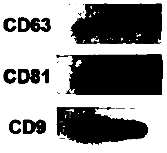 Obtaining method and application of exosomes derived from human urine cells