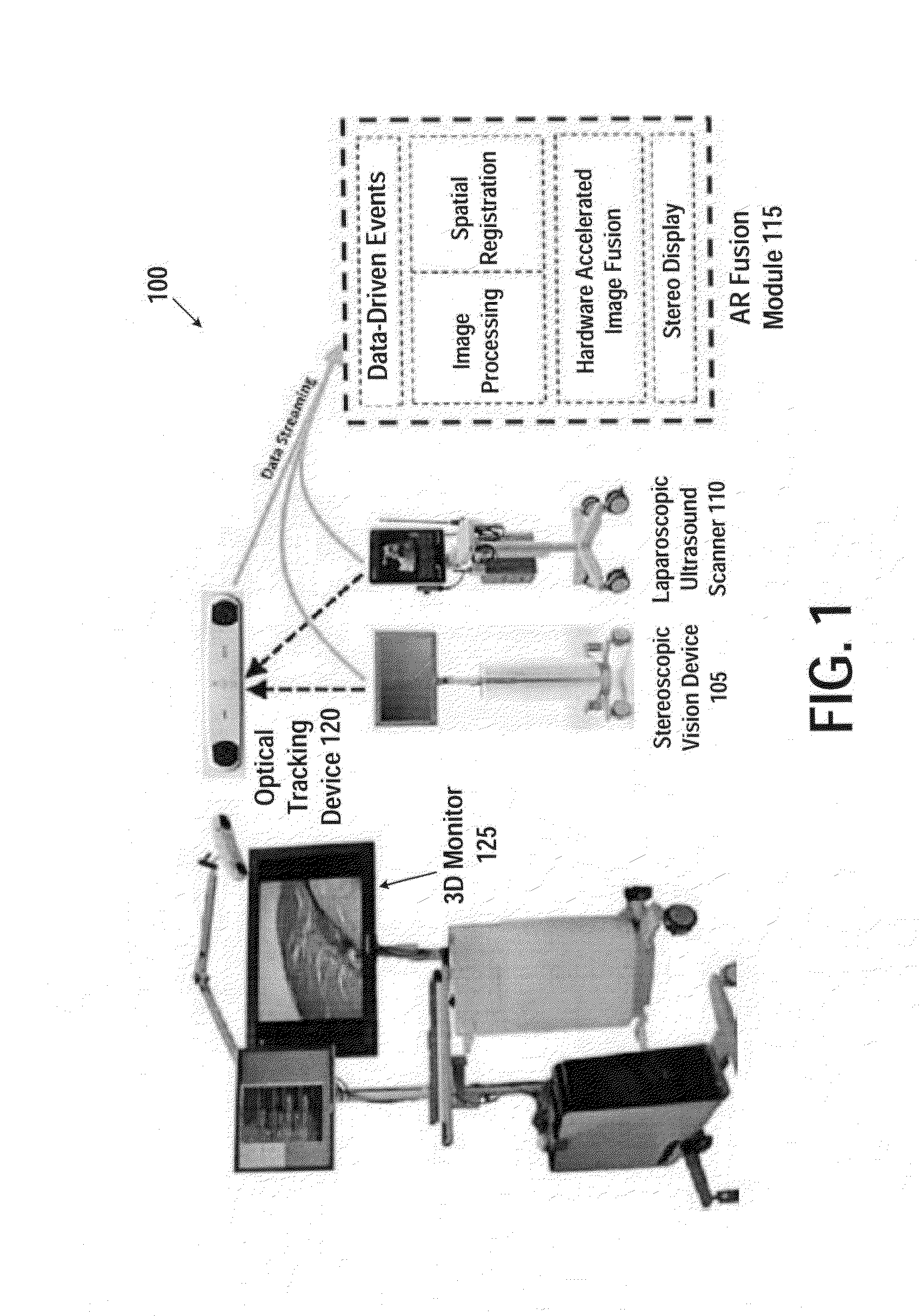 Device and method for generating composite images for endoscopic surgery of moving and deformable anatomy