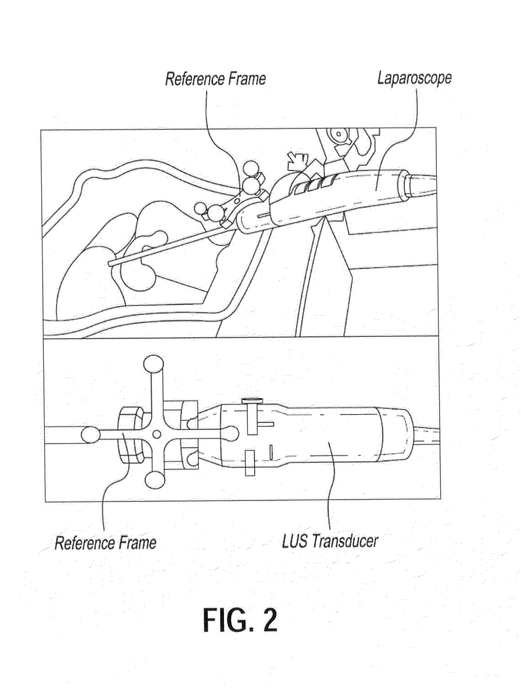 Device and method for generating composite images for endoscopic surgery of moving and deformable anatomy