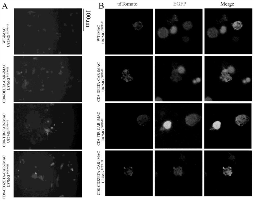 Macrophage exclusive chimeric antigen receptor, controllable polarized mononuclear/macrophage for expressing macrophage exclusive chimeric antigen receptor and preparation method and application thereof