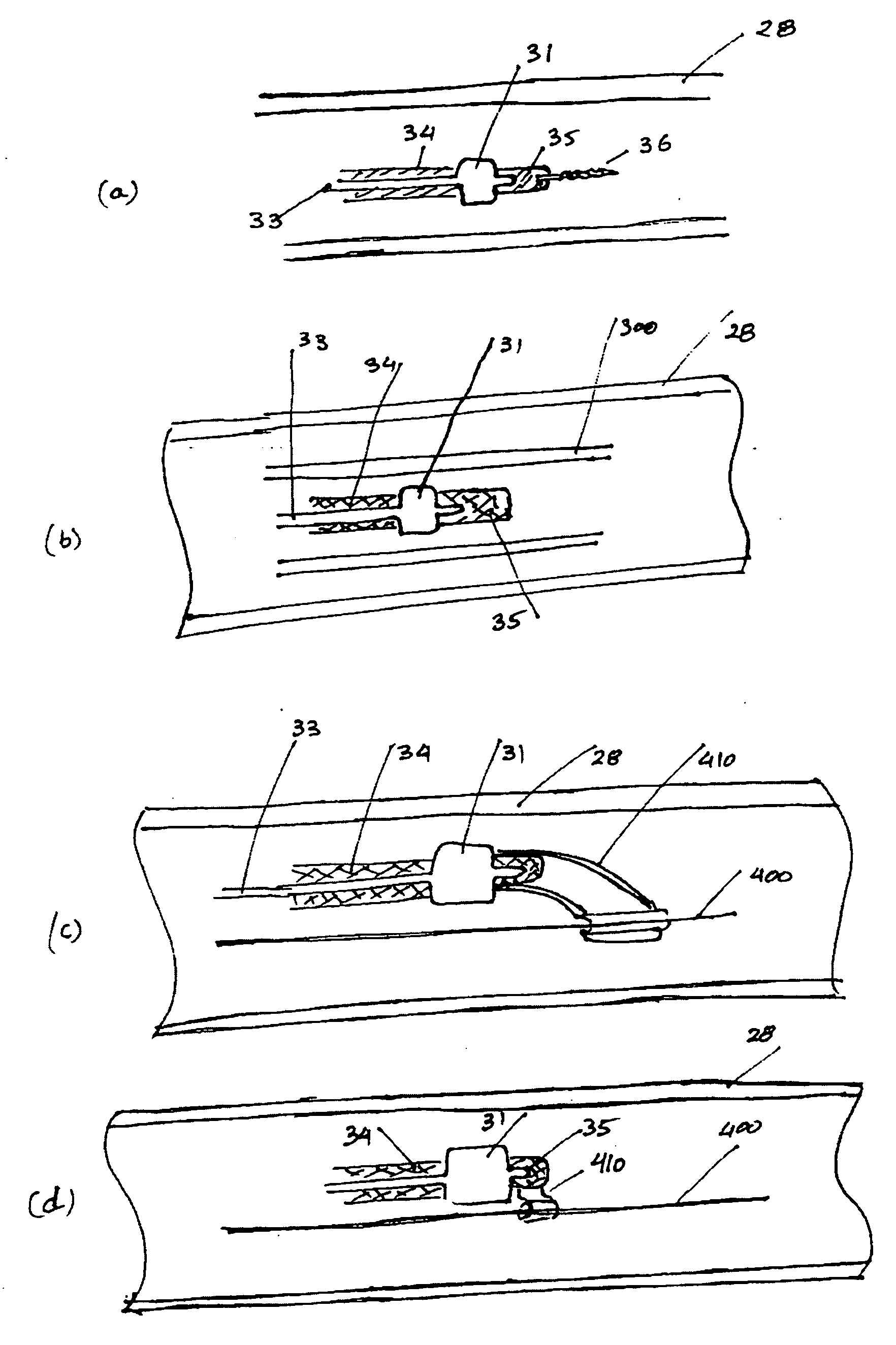 Radio-frequency device for passivation of vascular plaque and method of using same