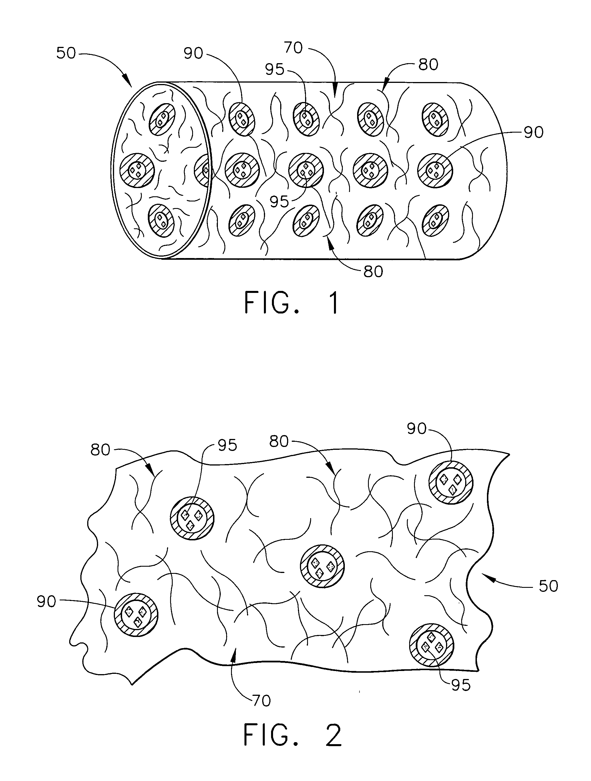 Biodegradable medical implant with encapsulated buffering agent