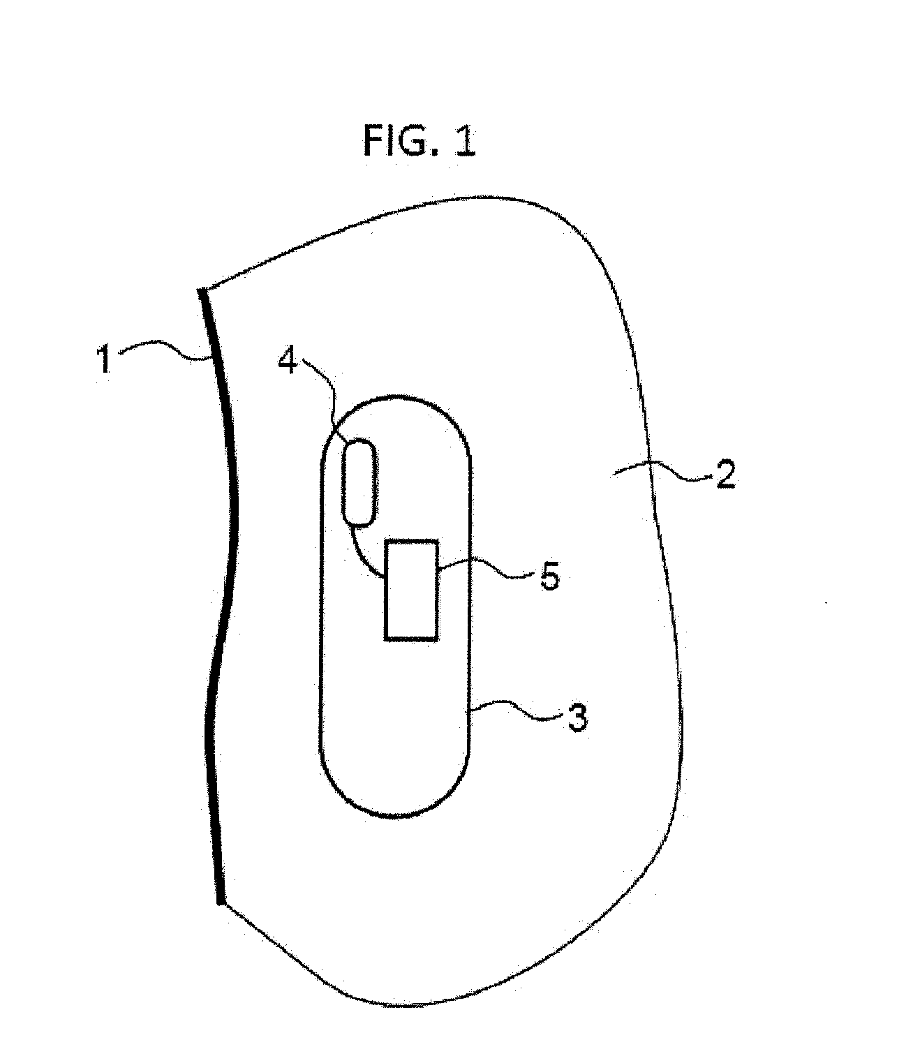 System for controlling an implantable device on the basis of commands issued by a user