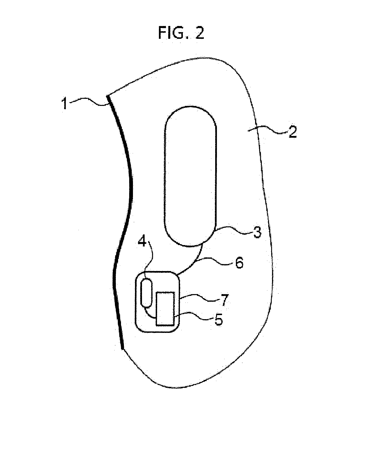 System for controlling an implantable device on the basis of commands issued by a user