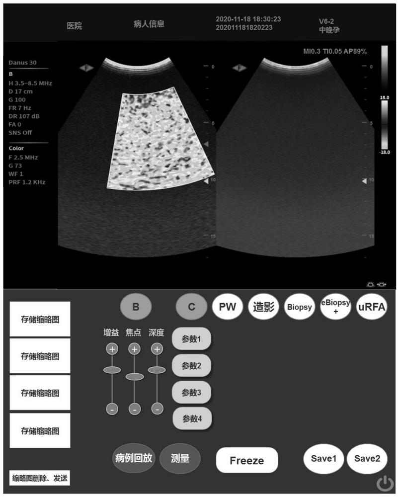 Ultrasonic diagnosis system and device for multi-screen display of ultrasonic images