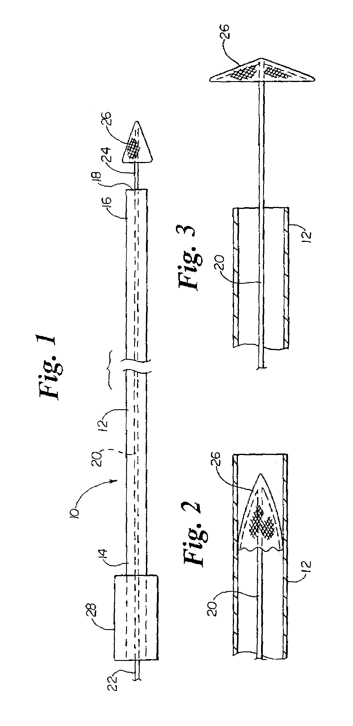Delivery and retrieval manifold for a distal protection filter